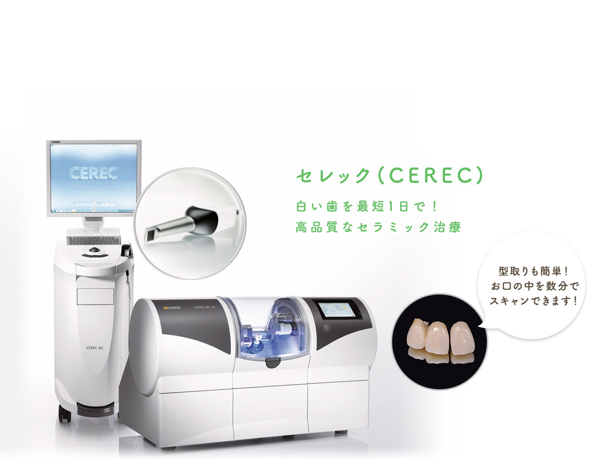 セレック(CEREC)白い歯を最短1日で！高品質なセラミック治療 型取りも簡単！お口の中を数分でスキャンできます！