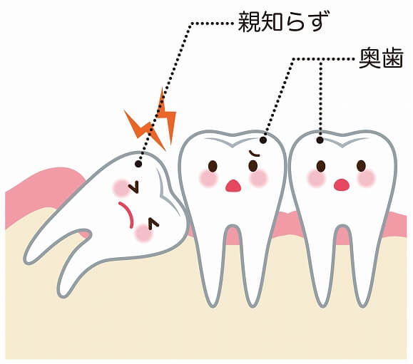 長岡市で親知らずの抜歯なら山田歯科クリニックへ