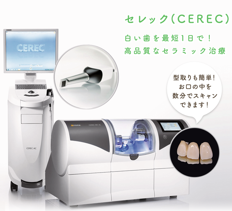 セレック(CEREC)白い歯を最短1日で！高品質なセラミック治療 型取りも簡単！お口の中を数分でスキャンできます！